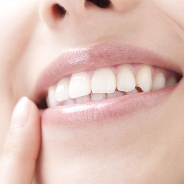 ホワイトニング